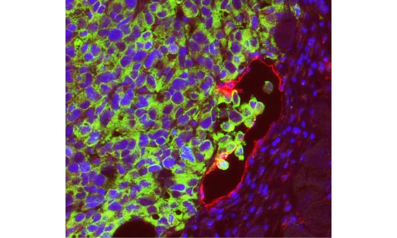 淋巴内皮细胞促进黑色素瘤扩散