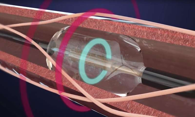 手术涉及超声波能量发现治疗高血压