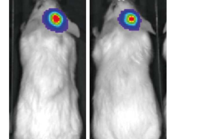 免疫介导杀伤HER2+乳腺癌细胞的T细胞双特异性抗体
