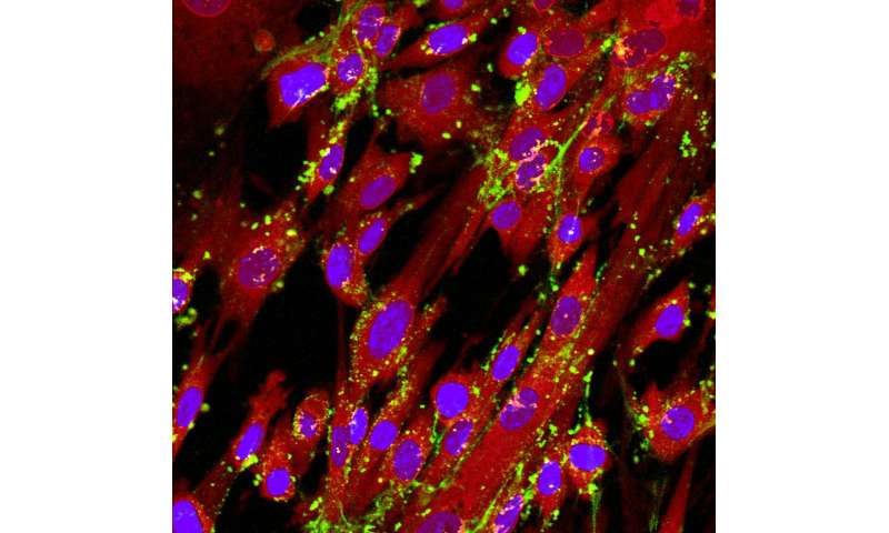 For nanomedicine, cell sex matters