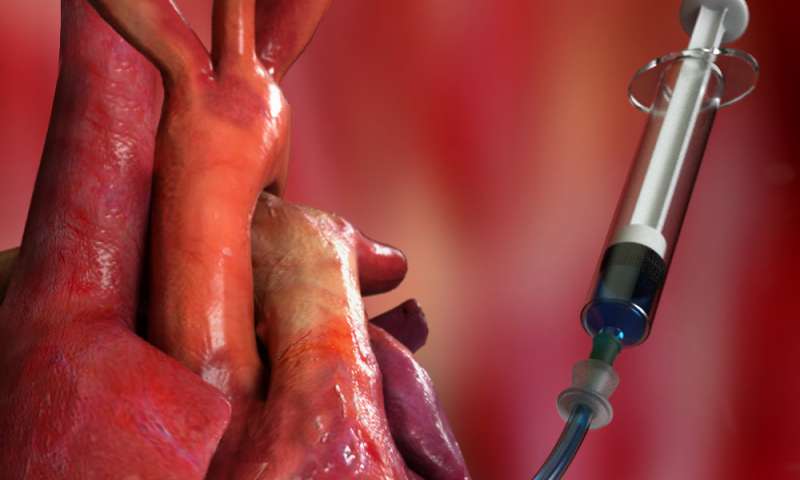 Implantable device delivers drugs straight to the heart