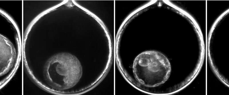 是马赛克胚胎是IVF的“黑马”？