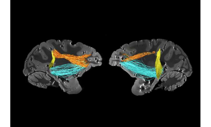 A surprising new source of attention in the brain