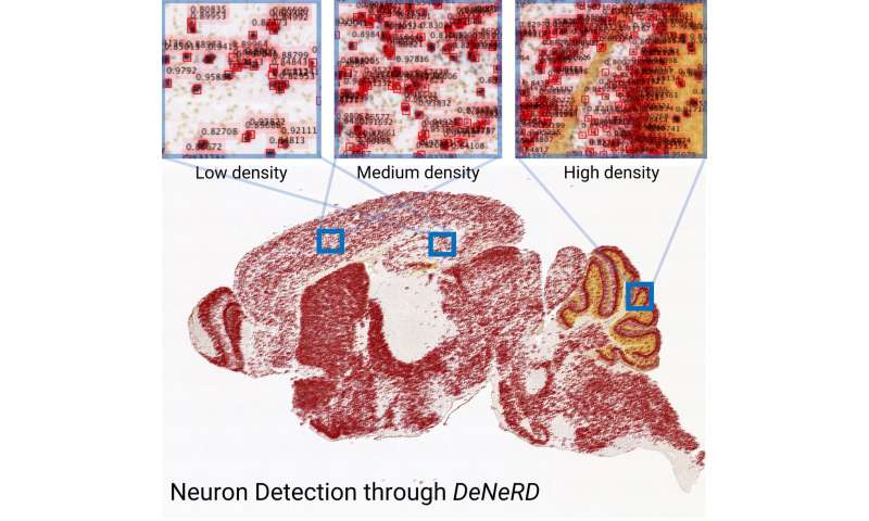 DeNeRD: an AI-based method to process whole images of the brain