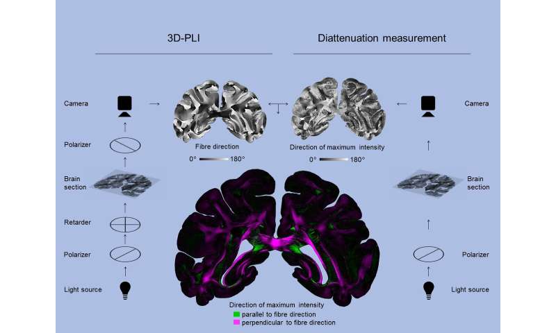 Diattenuation imaging -- a promising imaging technique for brain research