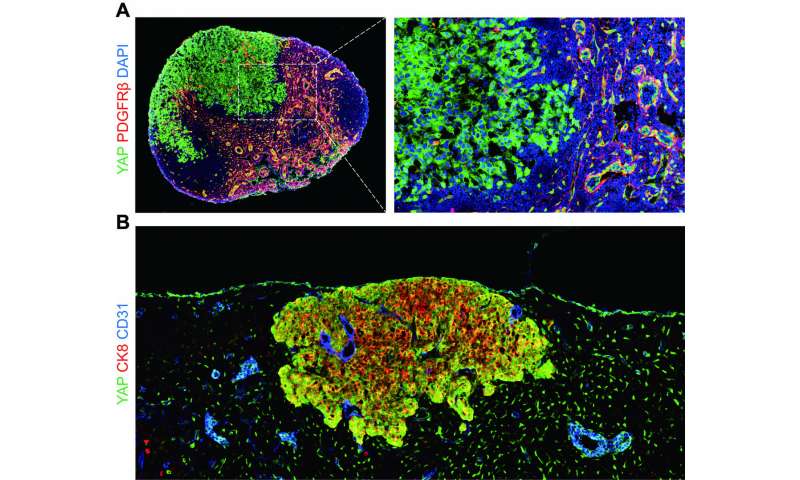 转移性肿瘤细胞如何在淋巴结中生长?