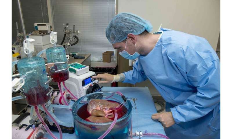 科学家将人类捐赠肝脏的储存时间延长了三倍