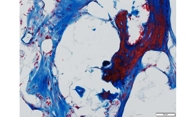 Johns Hopkins researchers define cells used in bone repair