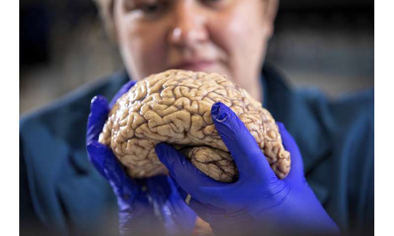 Scientists rethink Alzheimer's, diversifying the drug search