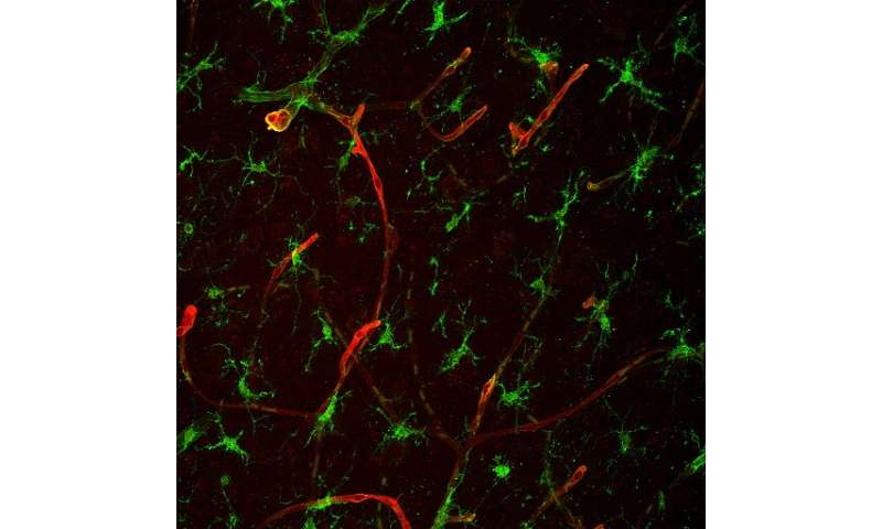 Scientists identify protein that promotes brain metastasis