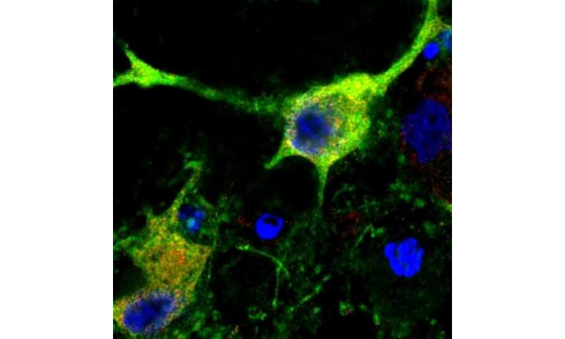 Researchers identify brain protein crucial to recovery from stroke