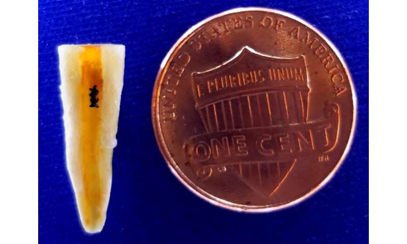An army of microrobots can wipe out dental plaque