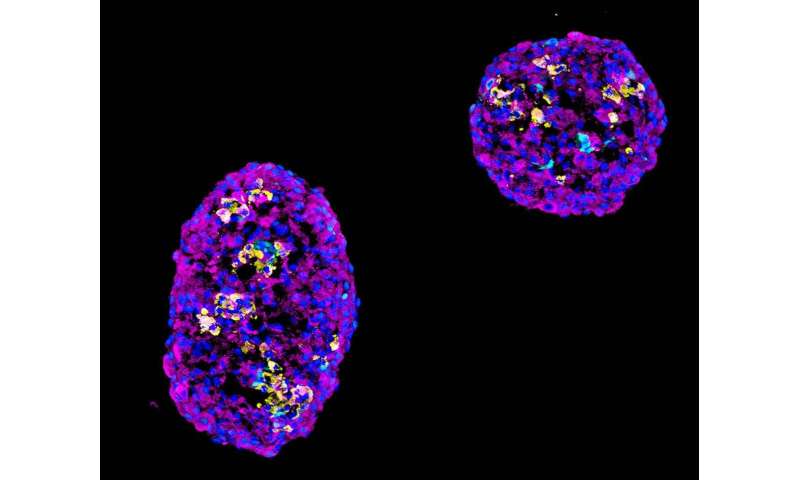 Research boosts the yield of insulin-producing cells for diabetes therapy