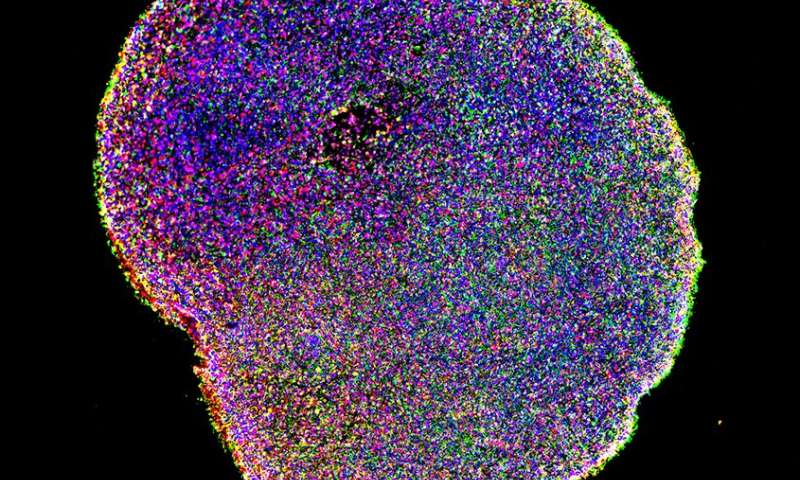 Improved human brain organoids to boost neurological disease research