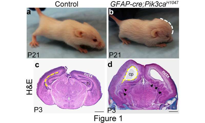 [Dialog] New mechanism driving cortical gyrification and hydrocephalus found in mice – suggests scope for novel therapy