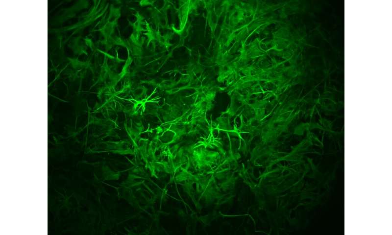 Brain's astrocytes play starring role in long-term memory