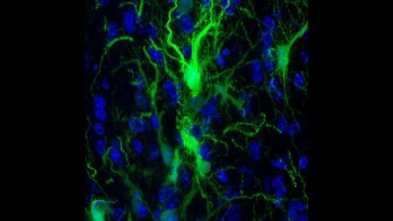 By exploiting a feature of the immune system, researchers open the door for stem cell transplants to repair the brain