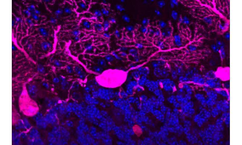 Neurodegenerative diseases may be caused by transportation failures inside neurons