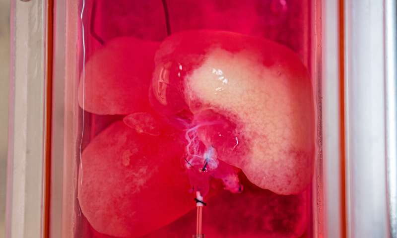 Pitt first to grow genetically engineered mini livers to study disease and therapeutics