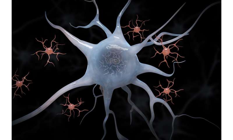 Targeting immune cells may be potential therapy for Alzheimer's