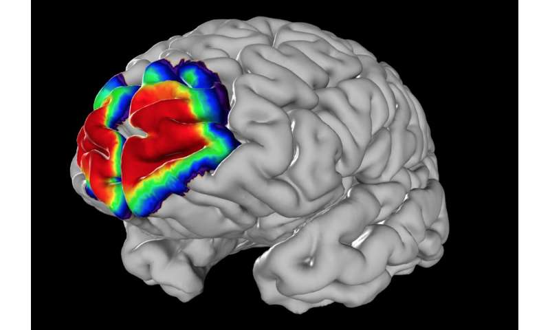 A centerpiece of EBRAINS' human brain atlas is presented in 'Science'