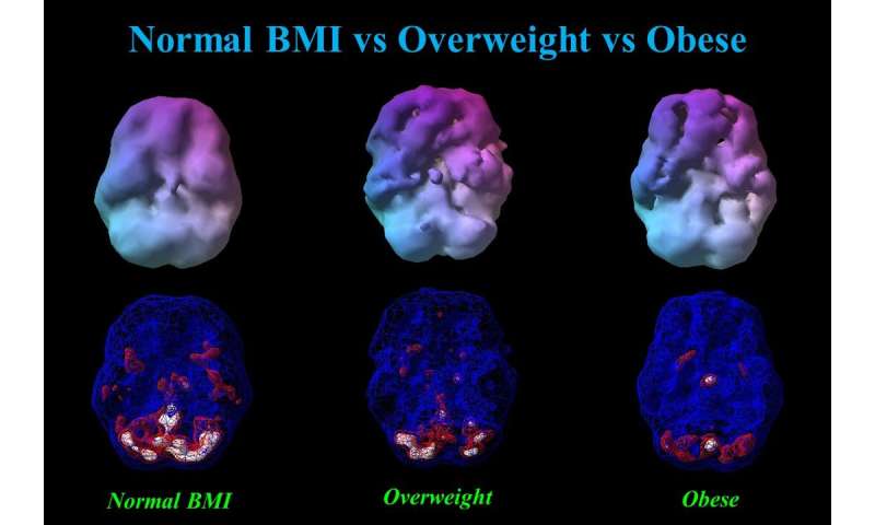 Body weight has surprising, alarming impact on brain function
