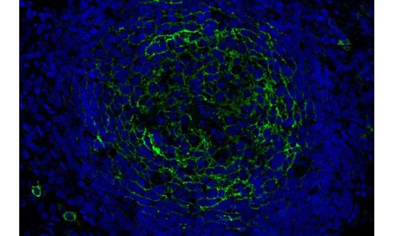 发现癌细胞如何逃避免疫防御激发新的治疗方法
