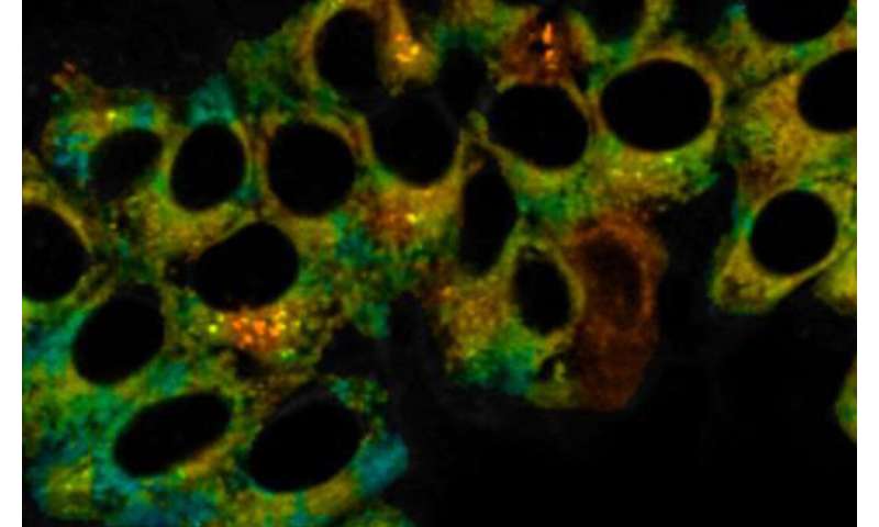 Double detection of cell changes could diagnose disease earlier