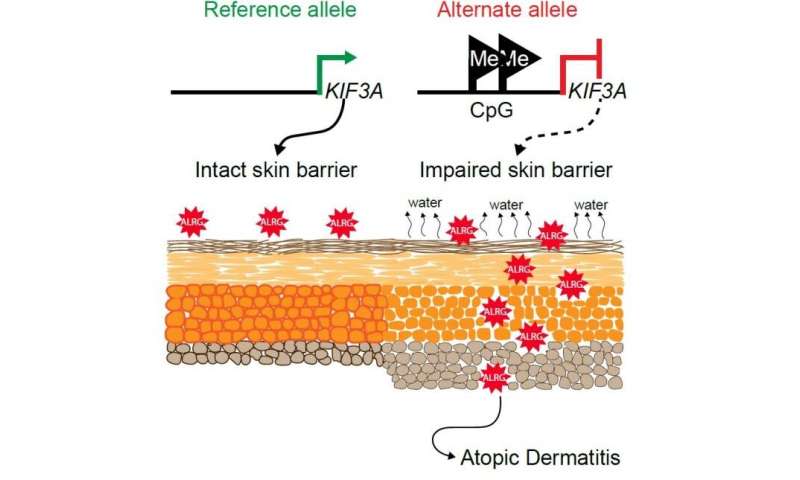 Gene variants help explain connection between skin disorder and food allergy risk