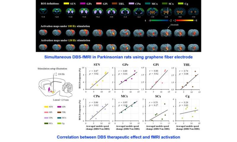 MRI兼容DBS电极的关键进展与同声DBS-FMRI