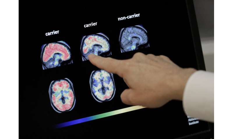 Medicare coverage for Alzheimer brain scans in question