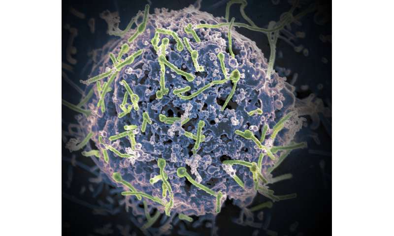 New universal Ebola vaccine may fight all four virus species that infect humans