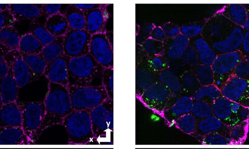 Novel technique spotlights neuronal uptake of amyloid beta in Alzheimer's disease thumbnail