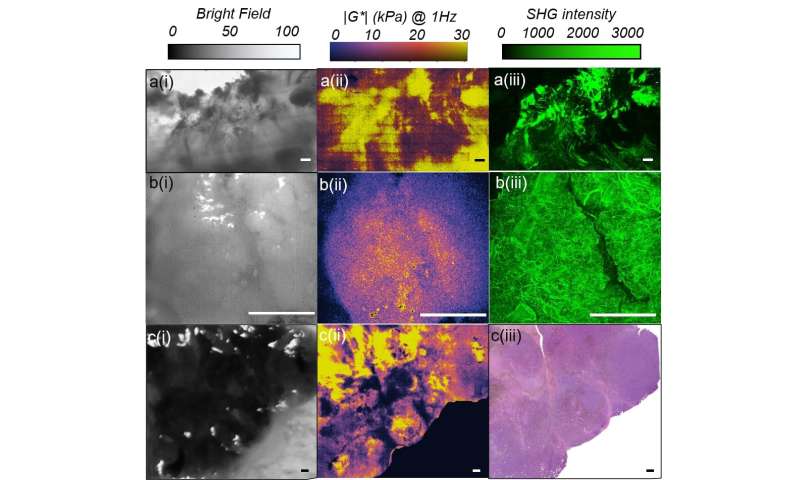 Optical Imaging of Tissue Mechanics via Laser Speckle Rheology