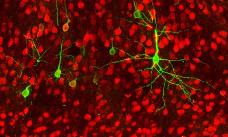 Study traces brain-to-gut connections