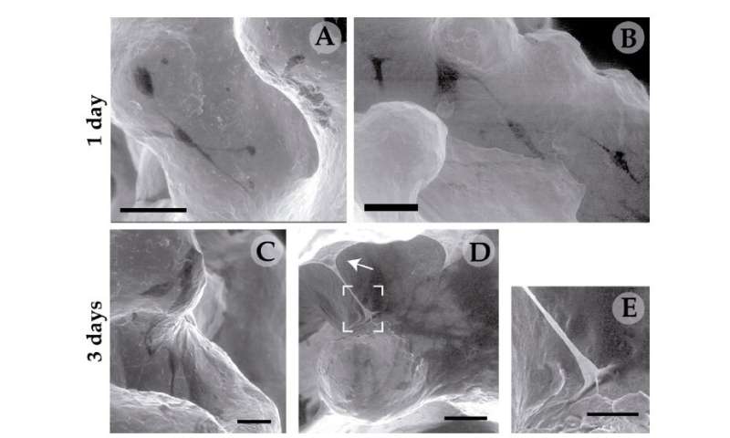 Development of a 3-D titanium-based structure to improve bone implants