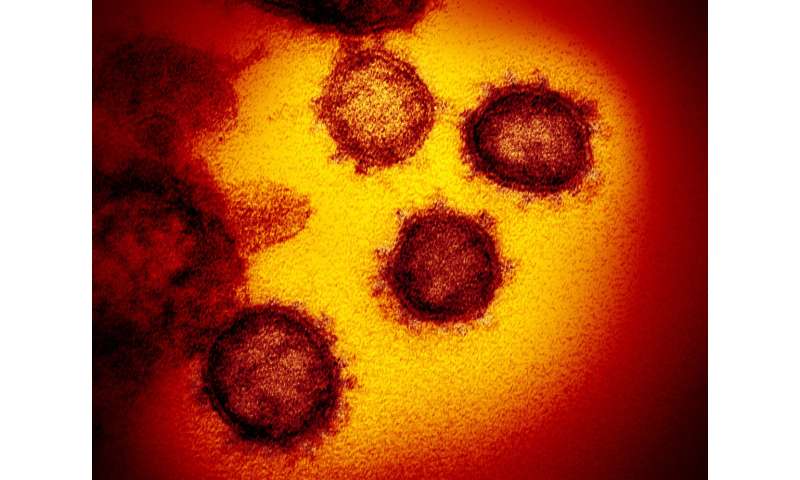 New coronavirus test is imperfect step toward mass screening