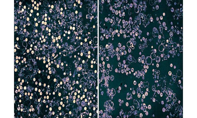 Researchers discover how chlamydiae multiply in human cells