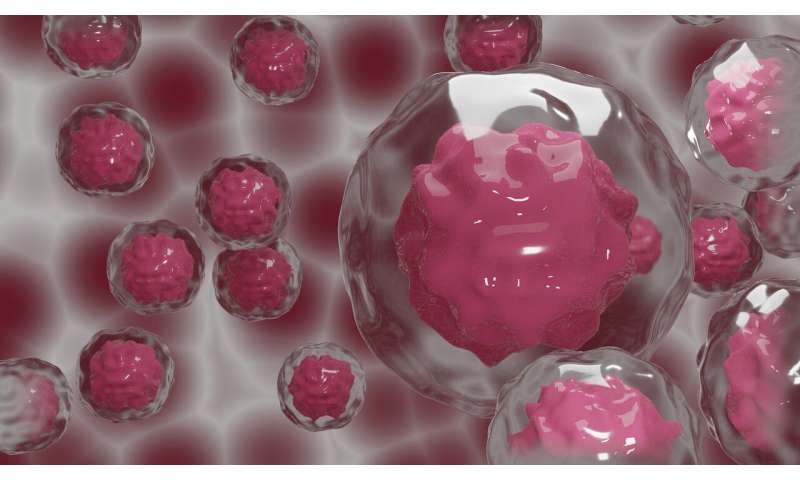 'Turncoat' macrophages in the tumor 'micro-environment' underlie breast cancer progression thumbnail