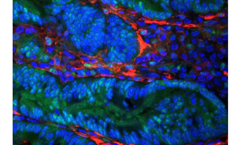 Research reveals why some tumors have different makeup of cells