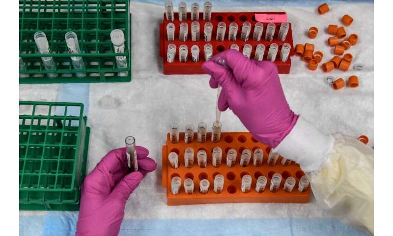 Um técnico de laboratório seleciona amostras de sangue para um estudo da vacina COVID-19 nos Centros de Pesquisa da América em Hollywood, Flórida.