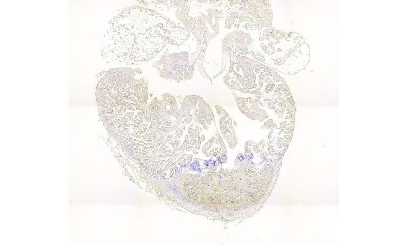 Heart muscle cells change their energy source during heart regeneration