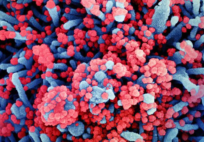COVID-19 antibody surveys underestimate infections: study thumbnail