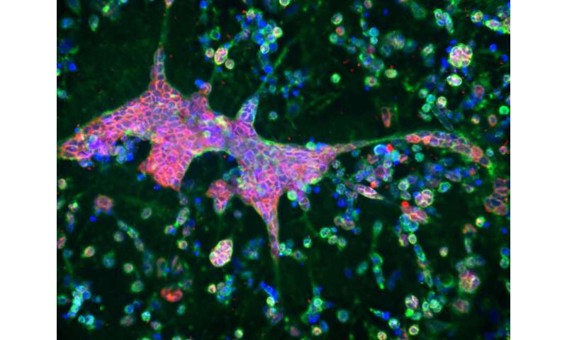 3D brain-like tissue model links Alzheimer's disease with herpes