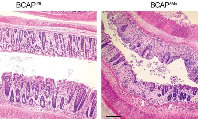 BCAP protein could help the body repair intestinal tissue ...