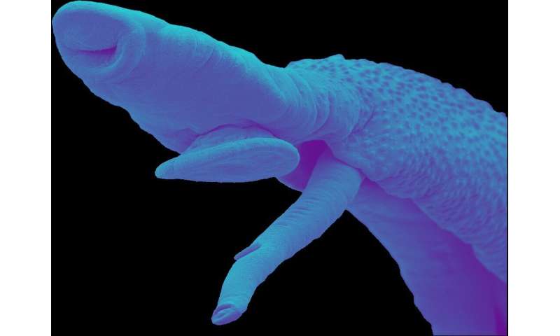 Finding the Achilles' heel of a killer parasite