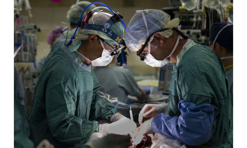 'Power of positive': Michigan conjoined twins separated