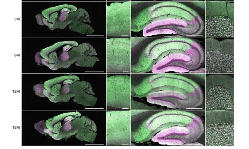 Study shows how brain’s connections changes according to age