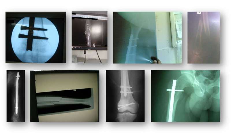 机器学习科学家教计算机读取x射线图像