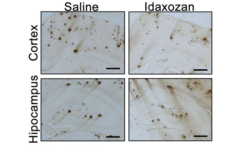 Pathogenic Alzheimer's disease cascade is activated by faulty norepinephrine signaling